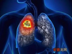 肺腺癌能根治吗