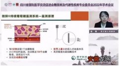 CGM优化血糖监测管理——移宇科技亮相四川省国际医学交流促进会