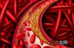 血管堵塞会导致很多疾病的出现如何清理血管呢