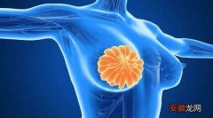 女人哪个部位最易生肿瘤 如何预防乳腺癌