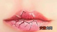 冬季空气干燥嘴唇干裂红肿应该如何应对