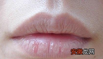 嘴唇经常起皮常见因素可能与以下三种情况有关