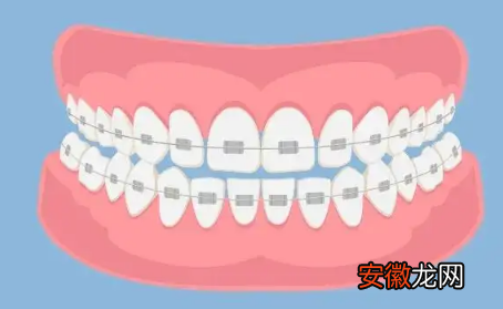 【烂牙】21岁一口烂牙很绝望怎么办?二十多岁牙齿就都烂了正常吗