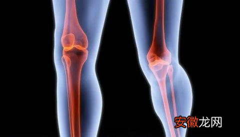 女性膝关节炎比男性在这6个方面显得脆弱，如何保护膝关节